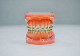 braces